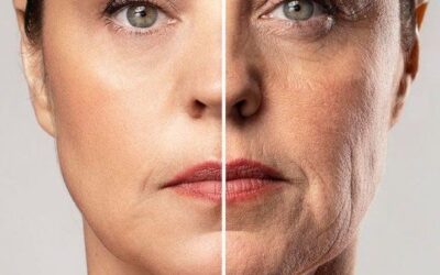 Sculptra en Tijuana: estimulación natural de colágeno para un rejuvenecimiento progresivo